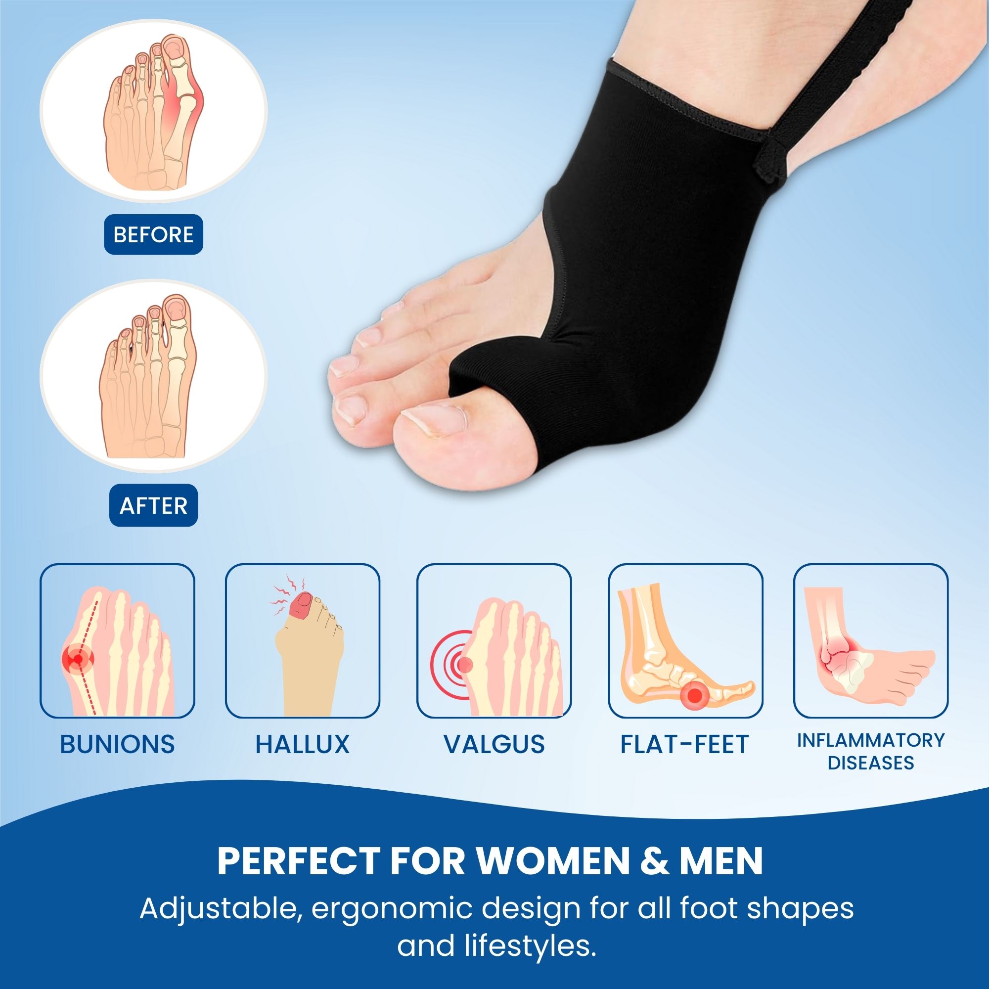 Bunion Corrector for Women & Men - Image 4