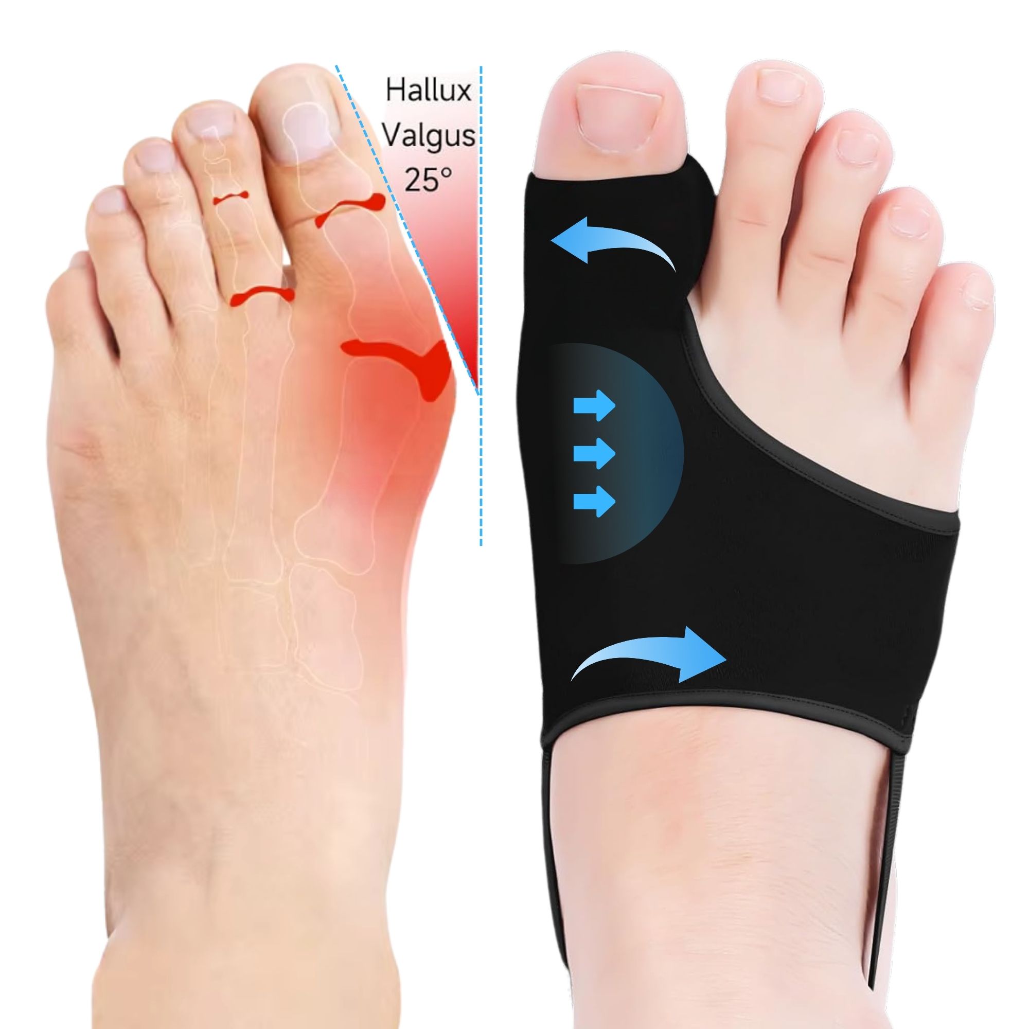 Bunion Corrector for Women & Men